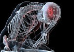 headache2