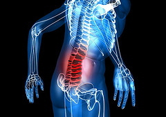 low_back_pain2