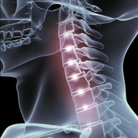 types_of_whiplash